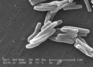 Científicos navarros participan en la investigación de nuevos fármacos para la tuberculosis