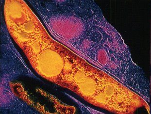 Dos buenas noticias desde la Universidad de País Vasco: lucha contra la tuberculosis y un premio